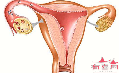 北京借卵-如果卵巢没有问题，输卵管就不会有问题吗？